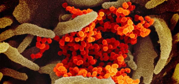 Coronavirus SarsCov2